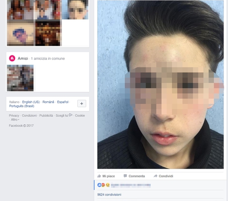 Il post di denuncia del padre di un ragazzo di 13 anni, vittima di bullismo, pubblicato sul profilo Facebook dell'uomo che lancia un appello a quanti sono vittime di violenza a denunciare "perché gli autori di tali soprusi non devono passarla liscia". Napoli, 18 marzo 2017. +++ATTENZIONE LA FOTO NON PUO' ESSERE PUBBLICATA O RIPRODOTTA SENZA L'AUTORIZZAZIONE DELLA FONTE DI ORIGINE CUI SI RINVIA+++